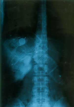 מג'די חדיד (רמאללה), "Ethnic X ray", צילום רנטגן